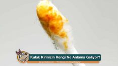 Kulak Kirinizin Rengi Ne Anlama Geliyor?